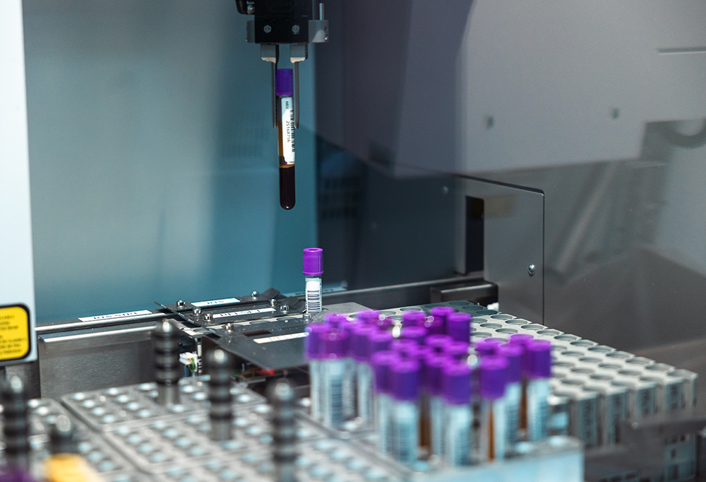 Kuvassa robotti siirtää veriputkiloa.